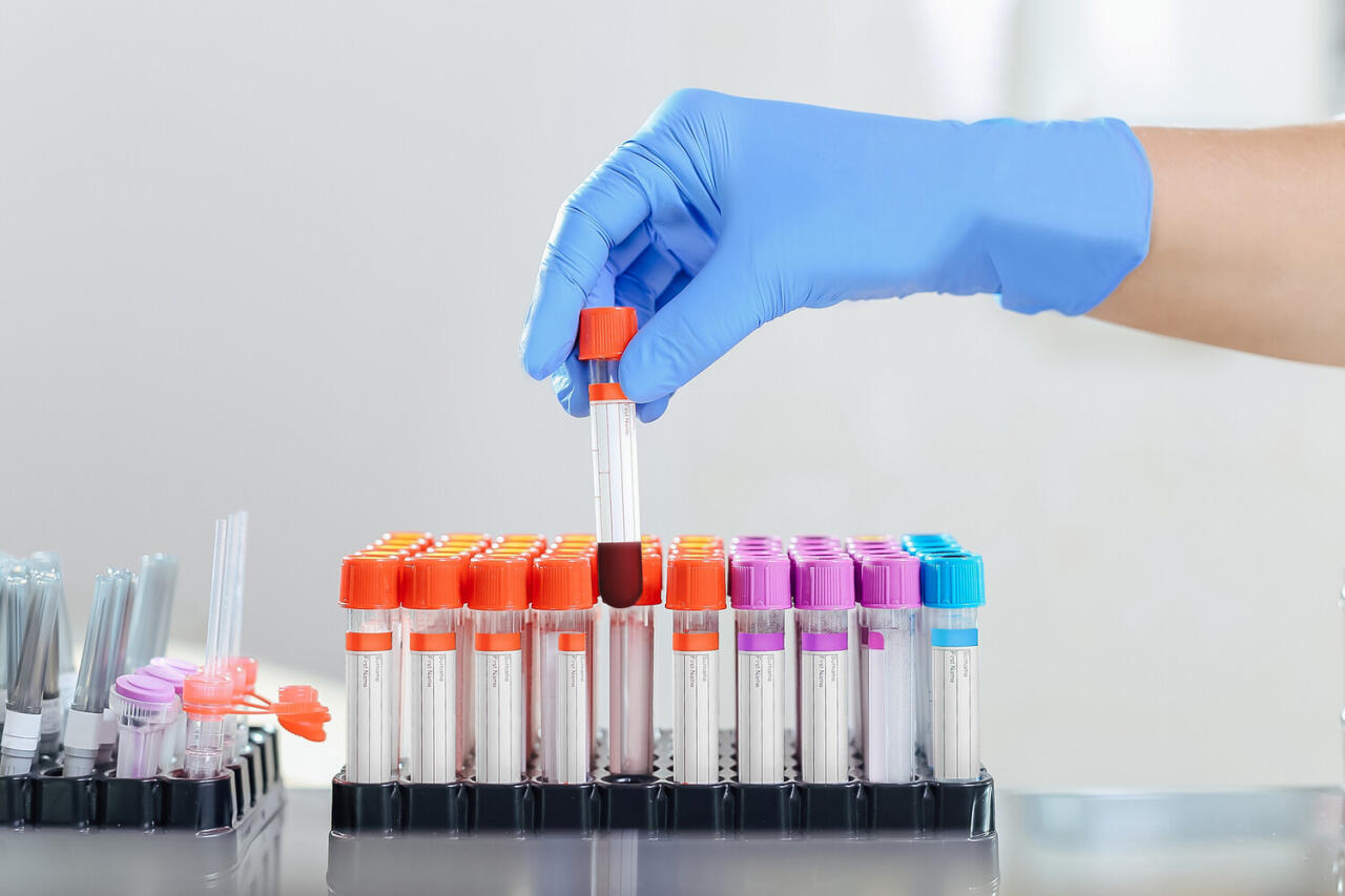 Bir damla qanla xərçəng diaqnostikası üçün test yaradıldı