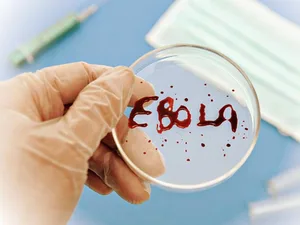 Konqoda Eboladan ölənlərin sayı 360 nəfərə çatıb